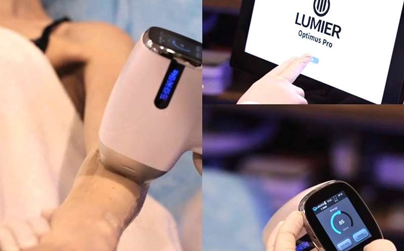 კავიტაცია - უოპერაციო ლიპოსაქცია უახლესი აპარატით